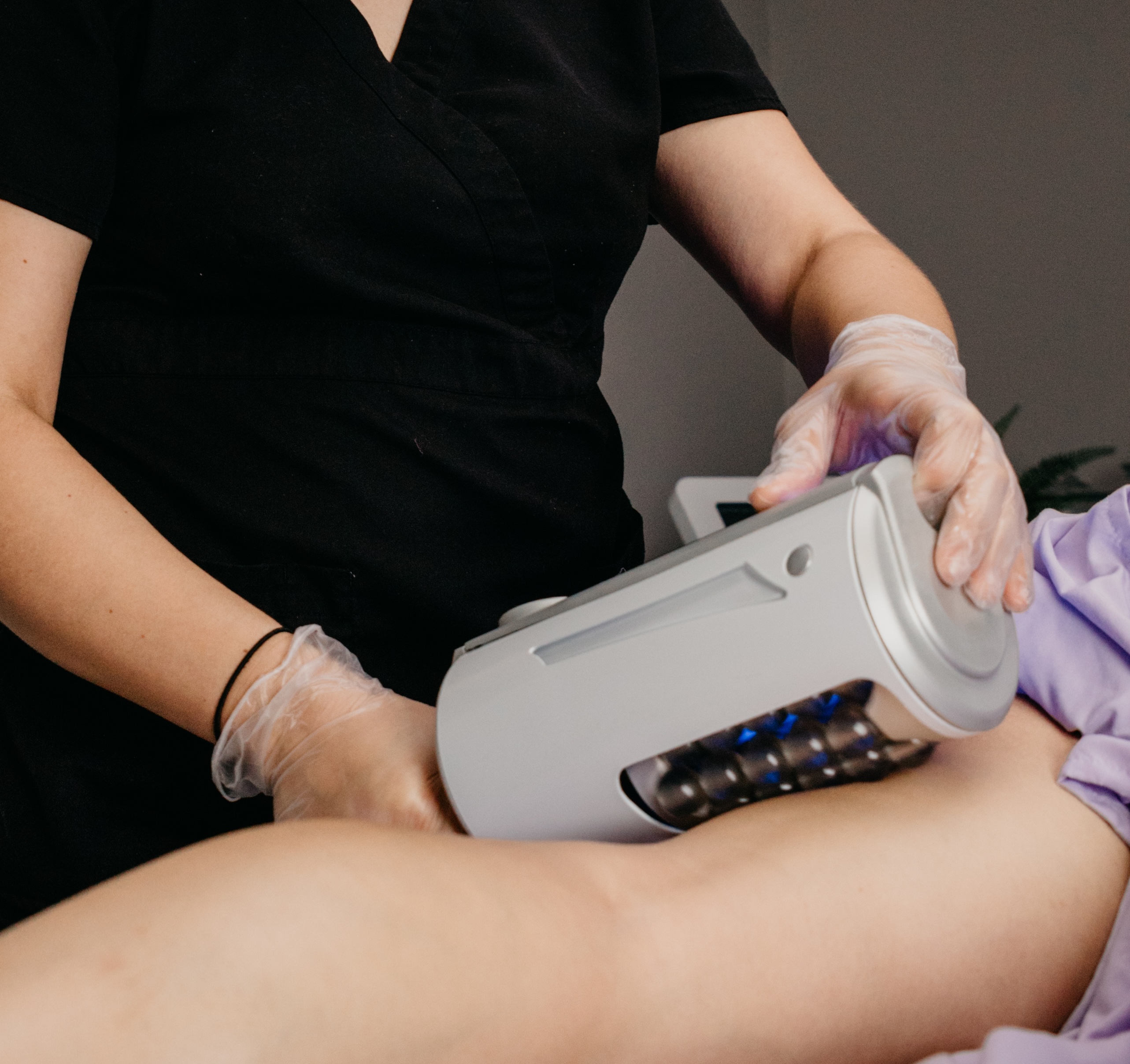 Venus Viva skin resurfacing treatment at Michel Laser Tempe