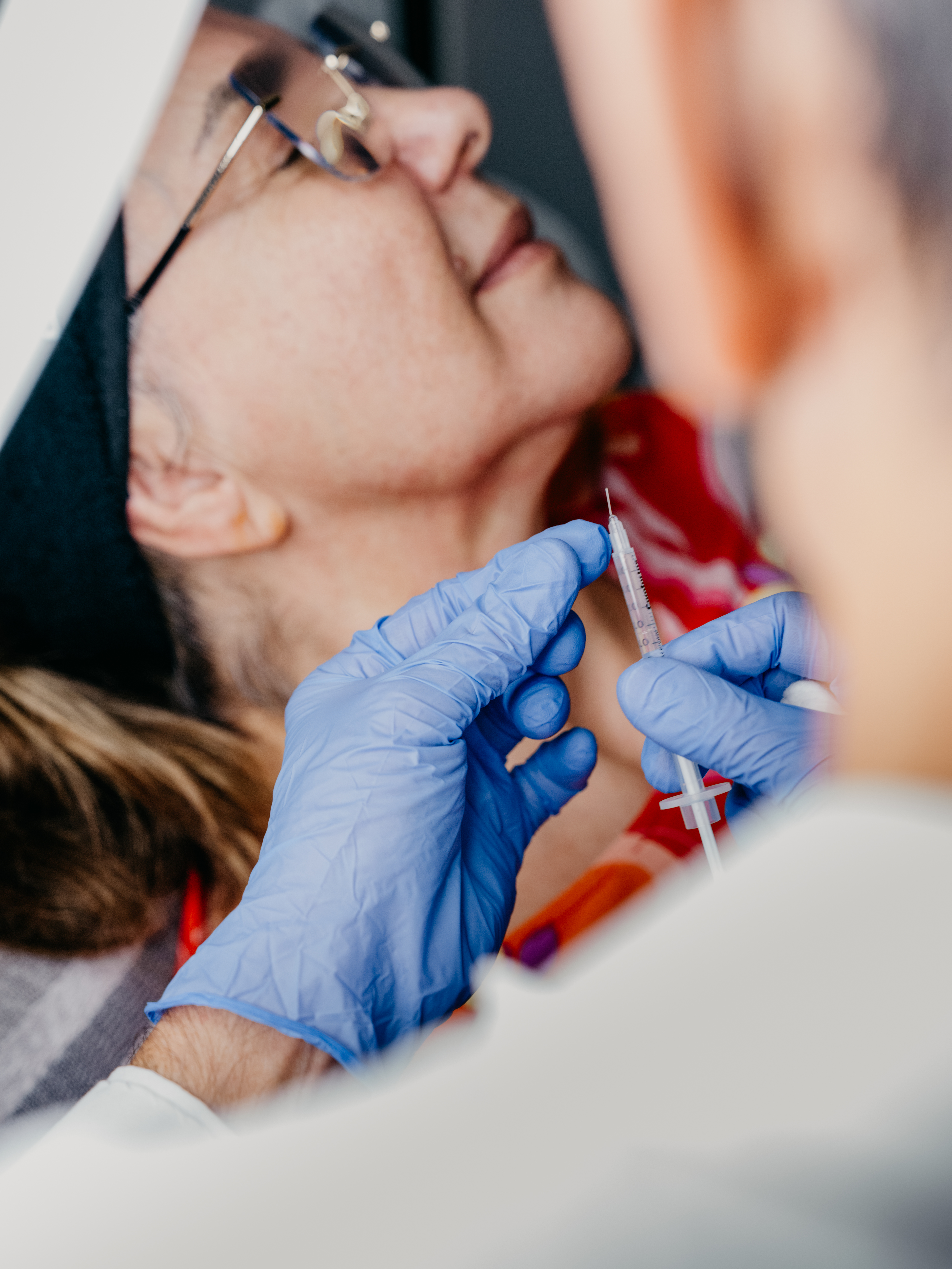 Lip filler and dermal filler treatment at Michel Laser Tempe