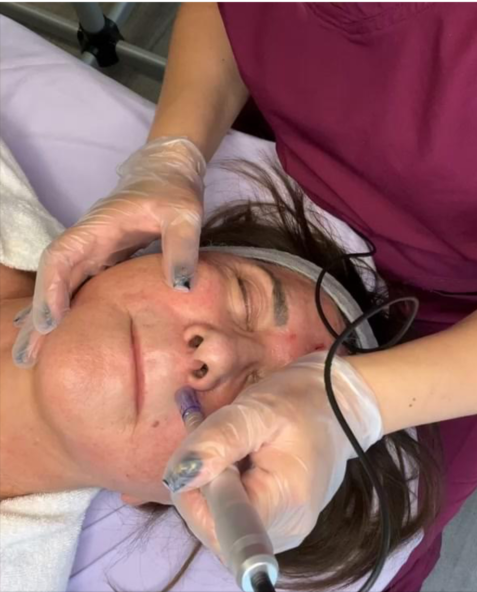 Geneo facial treatment at Michel Laser Tempe